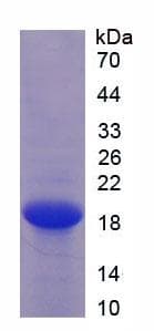 Human ESM1 / Endocan Protein (Recombinant His, N-Terminal)