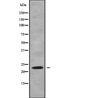 RAB13 Antibody