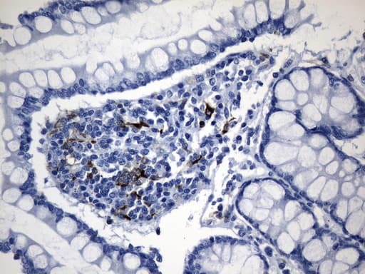 CTLA4 / CD152 Antibody (clone UMAB249)