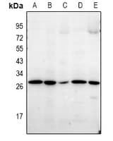 LDLRAD1 Antibody