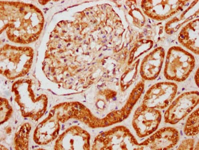 AMOT / Angiomotin Antibody (aa1-300)