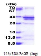 Human RPL5 / Ribosomal Protein L5 (Recombinant His)
