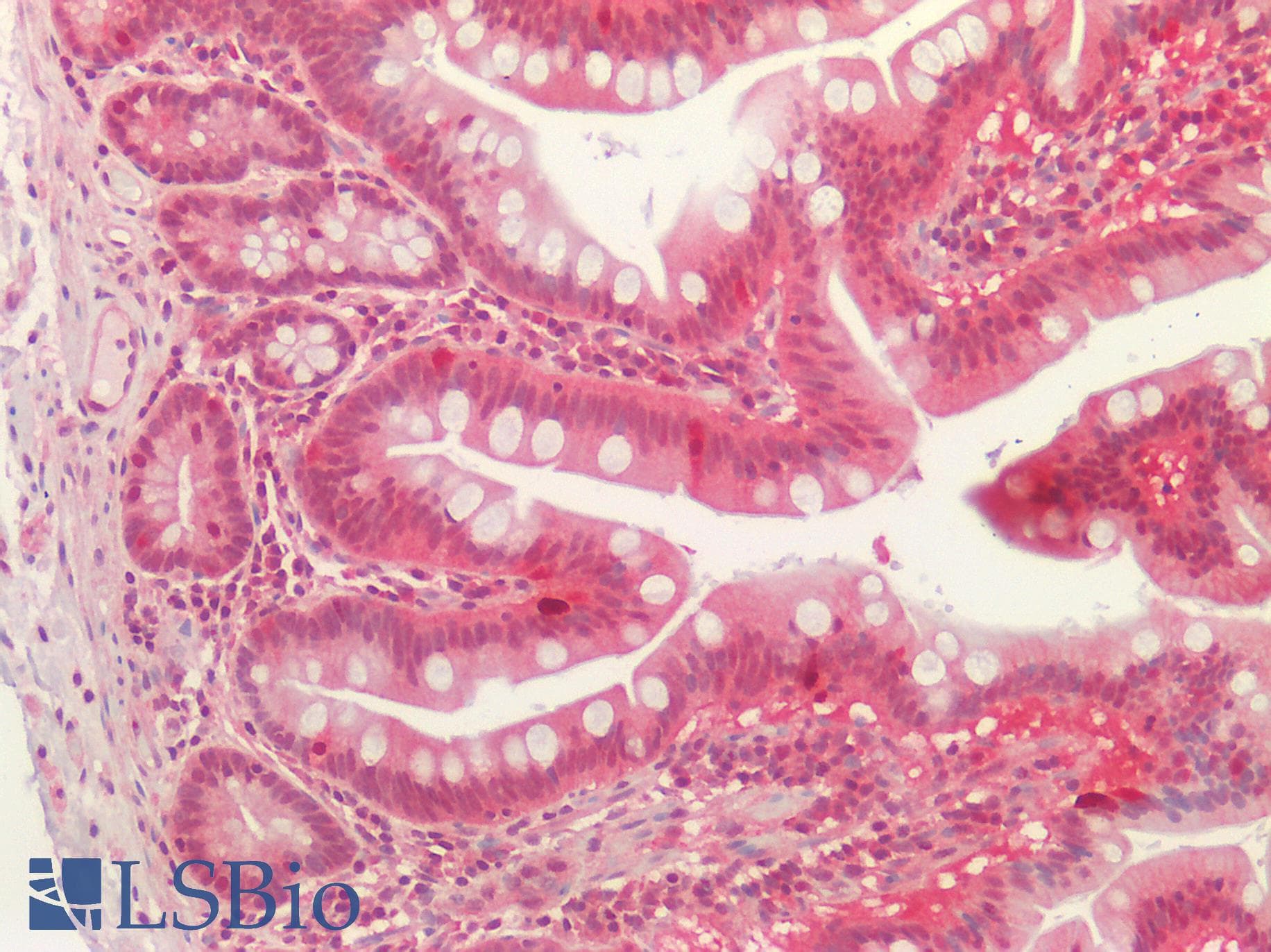 OTUB1 / OTU1 Antibody (clone AT17E10)