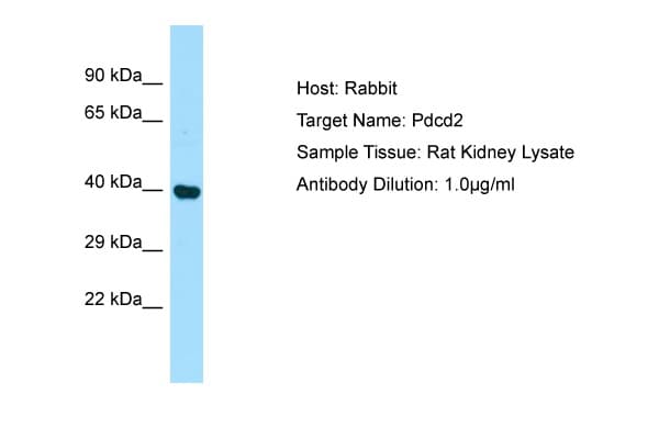 PDCD2 Antibody (aa91-140)
