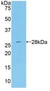 Human MASP2 / MASP-2 Protein (Recombinant His, N-Terminal)