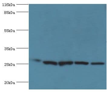 HSD17B10 / HADH2 Antibody (aa2-261)