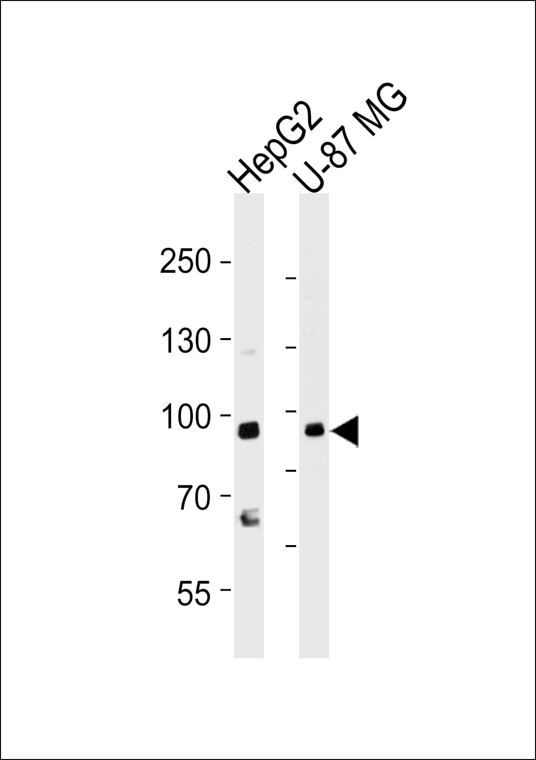 URG4 / URGCP Antibody (aa466-495)