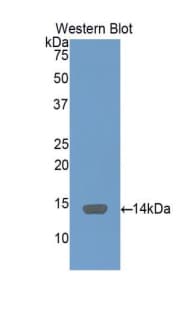 Serum Amyloid A Antibody (aa19-122, PE)