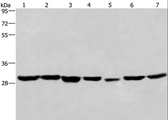 PHB / Prohibitin Antibody