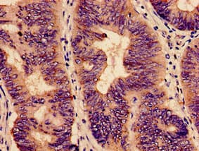 YBEY / C21orf57 Antibody