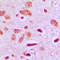 PPP1R14D / CPI17-Like Antibody (Internal)