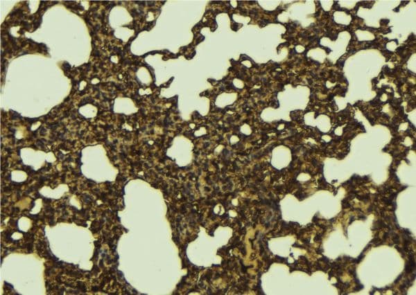 RENT1 / UPF1 Antibody