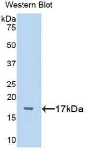 Polyclonal Rabbit anti-Human PLAGL1 / ZAC Antibody (aa226-362, WB)