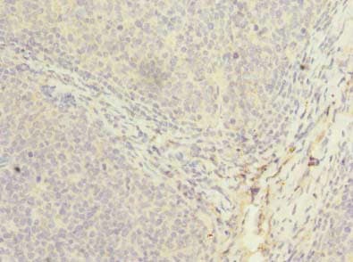 Polyclonal Rabbit anti-Human PPIH / Cyclophilin H Antibody (IHC, WB)