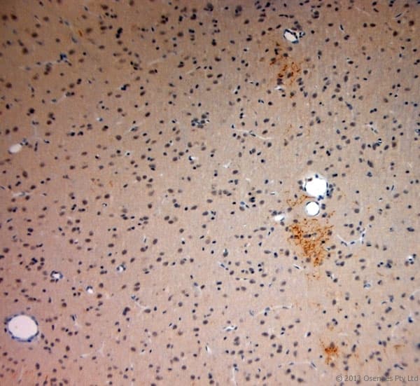 Polyclonal Rabbit anti-Rat SYNPO / Synaptopodin Antibody (aa890-930, IHC)