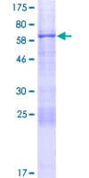 Human ASPHD1 Protein (Recombinant GST)