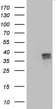CD63 Antibody (clone OTI1E10)