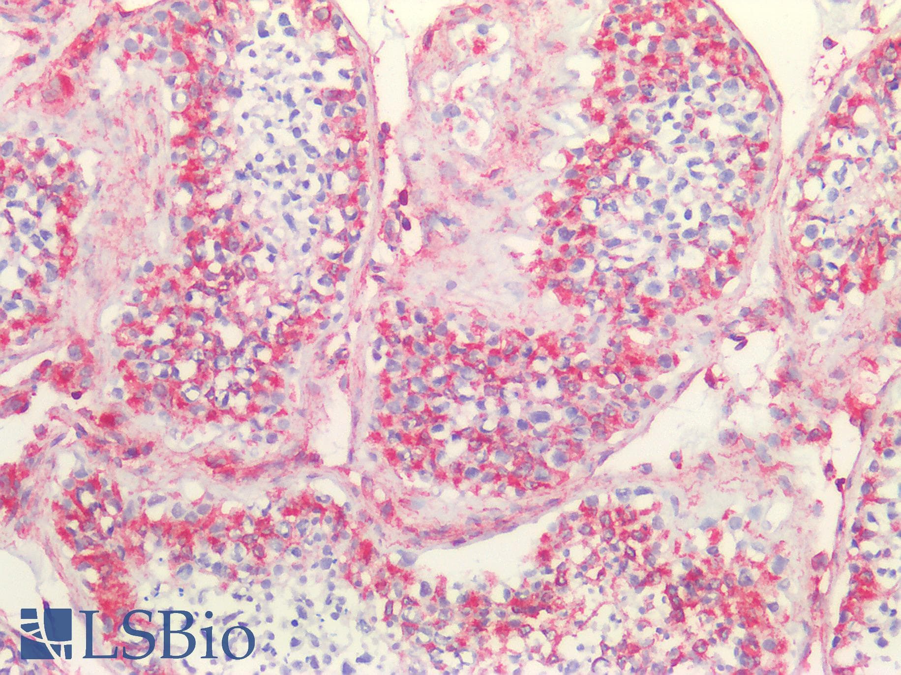IHC-plus™ Polyclonal Rabbit anti-Human Vimentin Antibody (IHC, IF, WB)
