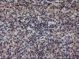 AKT1 Antibody (clone OTI4C11)