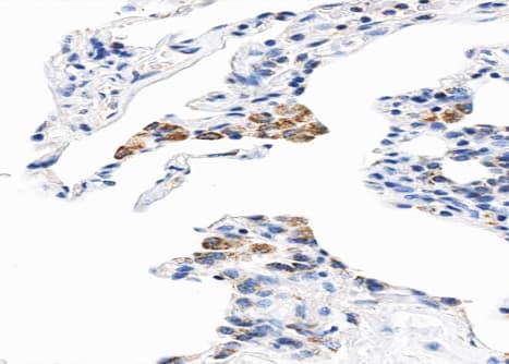 CYB5A / Cytochrome b5 Antibody