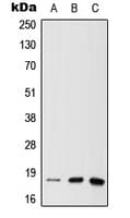 NUDT1 / MTH1 Antibody (N-Terminus)