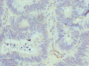 ACTR1A / Centractin Antibody (aa187-376)