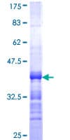 Human FCRL3 Protein (Recombinant GST, N-terminus)
