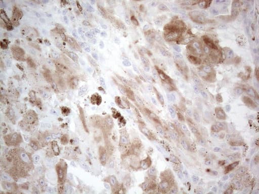 Monoclonal Mouse anti-Human MLANA / Melan-A Antibody (clone OTI6B12, aa48-118, IHC, WB)