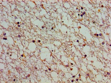 ATP2C1 Antibody