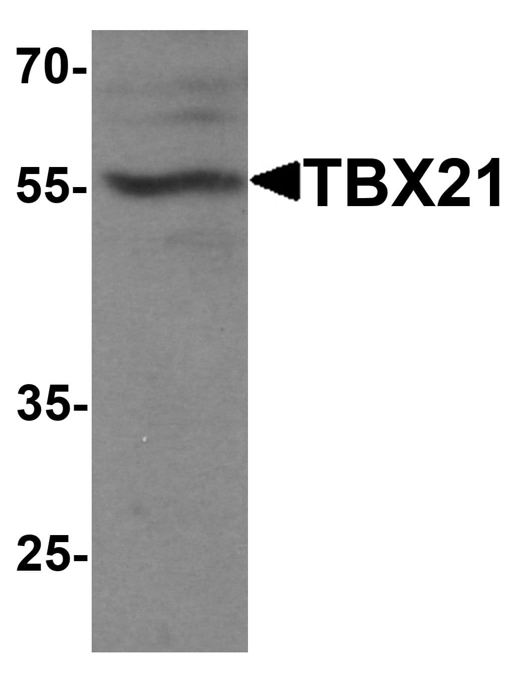 IHC-plus™ TBX21 / T-bet Antibody