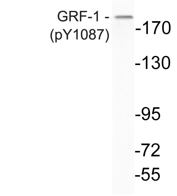 ARHGAP35 / GRLF1 Antibody (phospho-Tyr1087)
