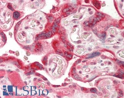 IHC-plus™ INHBA / Inhibin Beta A Antibody