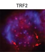 TERF2 / TRF2 Antibody (clone 4A794.15)
