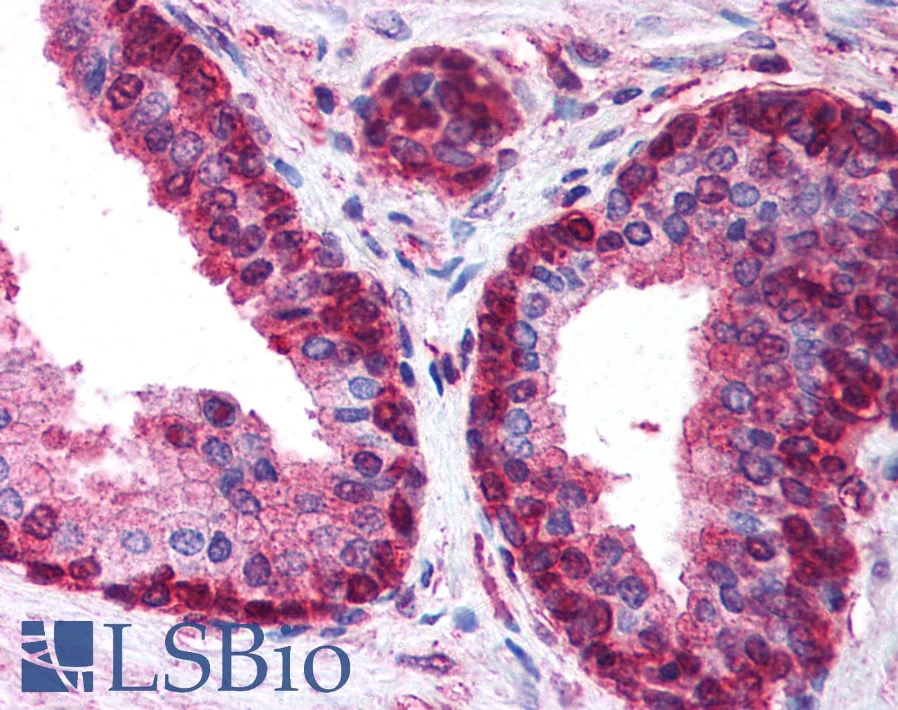 IHC-plus™ Polyclonal Rabbit anti-Human SAP30L Antibody (aa165-183, IHC)