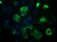 BCL10 / BCL-10 Antibody (clone OTI6A4)