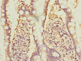 Polyclonal Rabbit anti-Human NFYB Antibody (IHC)
