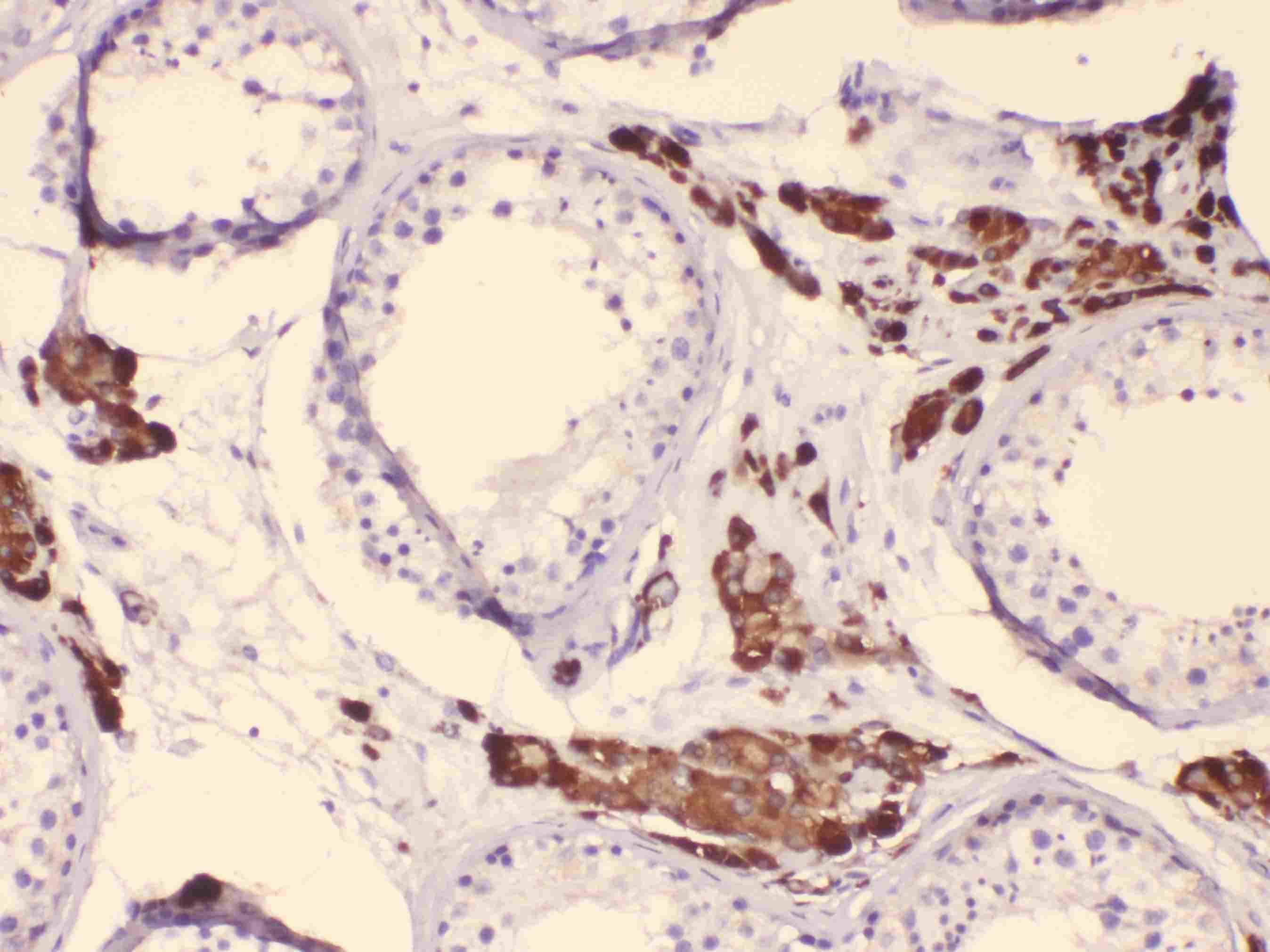 Polyclonal Rabbit anti-Human CYP17 / CYP17A1 Antibody (IHC, WB)