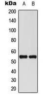 AML1 / RUNX1 Antibody (Internal)