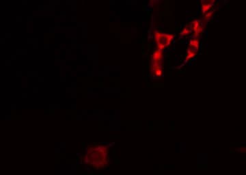 Polyclonal Rabbit anti-Human IL4R / CD124 Antibody (aa105-131, IHC, IF, WB)
