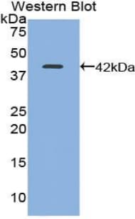 TFF1 / pS2 Antibody (aa1-87)
