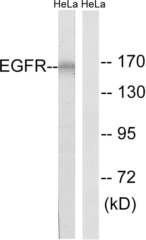 Polyclonal Rabbit anti-Human EGFR Antibody (aa991-1040, WB)