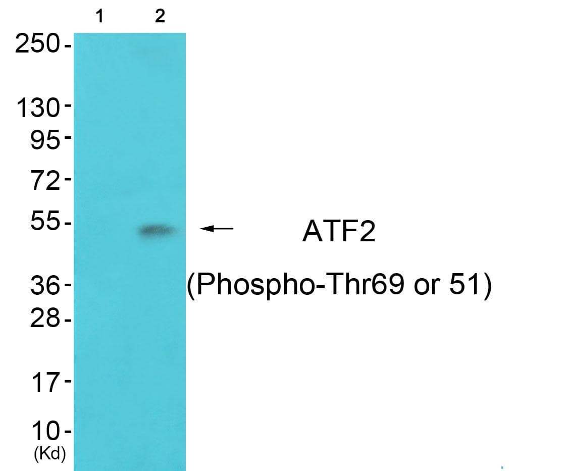 ATF2 Antibody (phospho-Thr69 or 51)