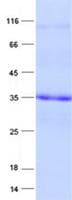 Human EMC2 / TTC35 Protein (Recombinant His, N-Terminal)