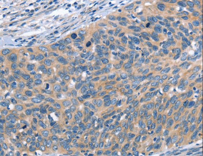 Polyclonal Rabbit anti-Human SCARB1 / SR-BI Antibody (IHC)