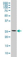 Monoclonal Mouse anti-Human RPL13 / Ribosomal Protein L13 Antibody (clone 3F6, IF, WB)