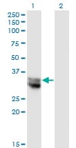 NIT1 Antibody (clone 1C3)