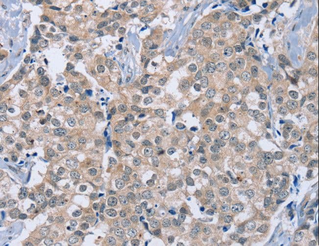 RAB8B Antibody