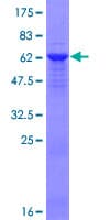 Human BRCC3 / BRCC36 Protein (Recombinant GST)