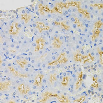 Polyclonal Rabbit anti-Human SYK Antibody (IHC, WB)