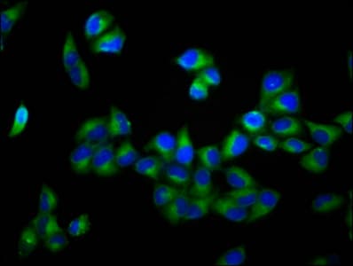 ADAM29 Antibody